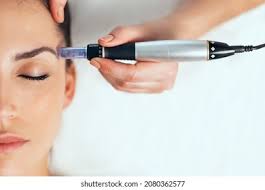 Rezenerate Eye Treatment